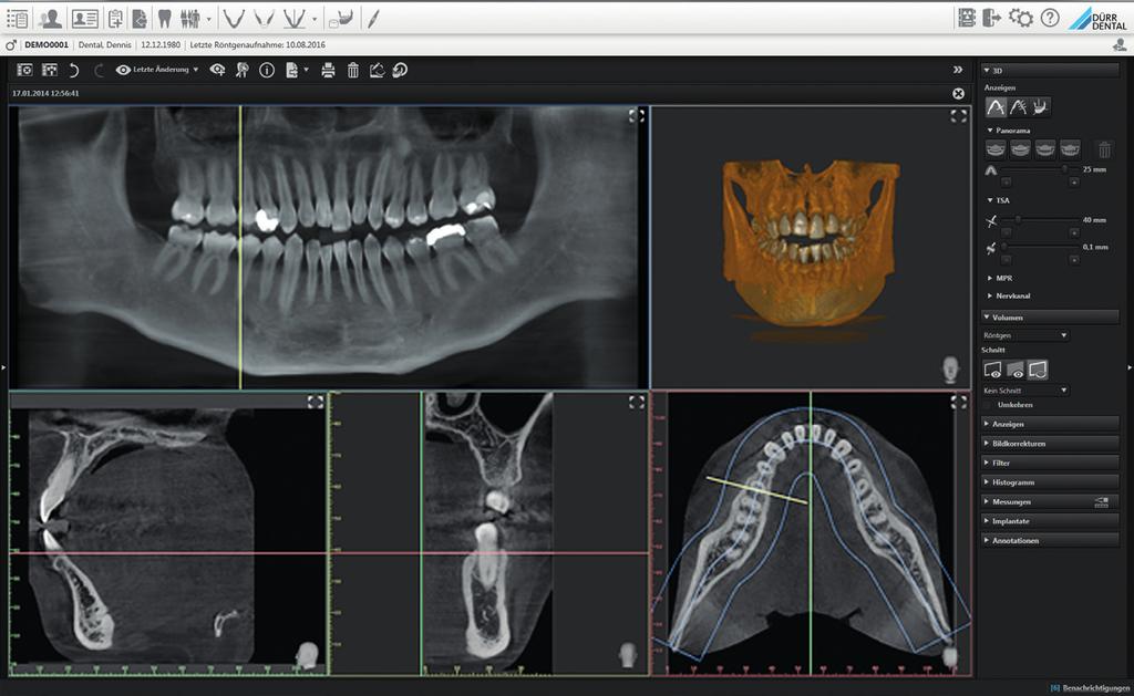 VistaSoft the diagnostics centre for your surgery Dürr Dental VistaSoft combines 3D and 2D X-ray images along with camera images and images imported from third-party hardware or from referring