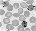 Diagnosis Blood Film Blood smear Thick and thin film Gold standard Antigen detection tests Rapid, simple (10-15 mins) Polymerase Chain Reaction (PCR) Plasmodium Life Cycle Electron Microscopy