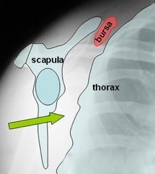 Scapulothoracic Articulation Not a true joint Provide the
