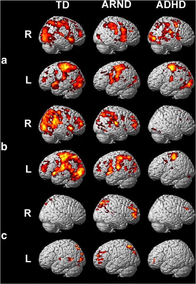 Malisza et al. Journal of Neurodevelopmental Disorders 2012, 4:12 Page 7 of 20 Figure 2 fmri activation maps for A) the 0-back contrast (FWE = 0.