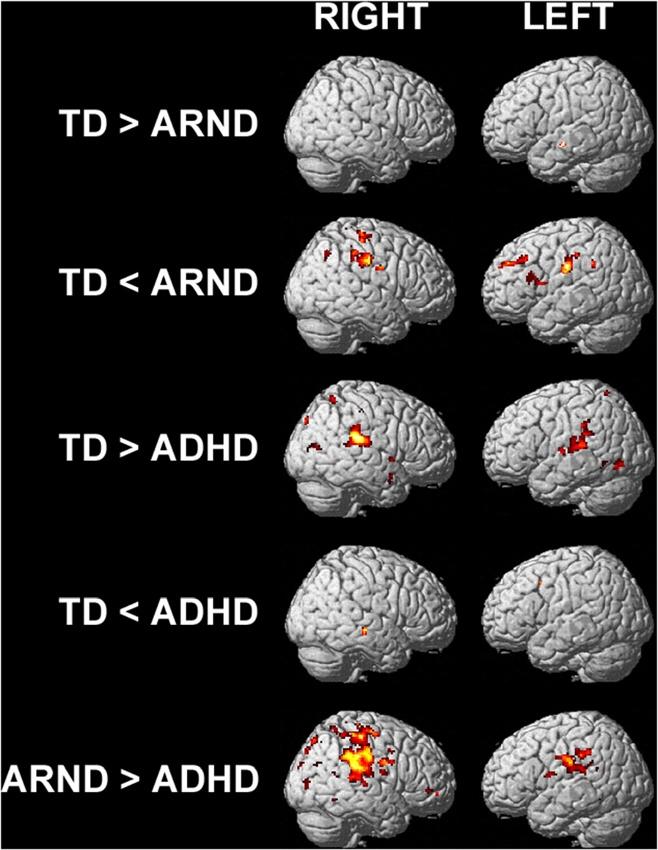 Malisza et al. Journal of Neurodevelopmental Disorders 2012, 4:12 Page 8 of 20 relative to the ADHD and ARND groups (TD-ADHD Z = 4.21, P < 0.0167; TD-ARND Z = 4.49, P < 0.0167; ADHD-ARND Z = 0.