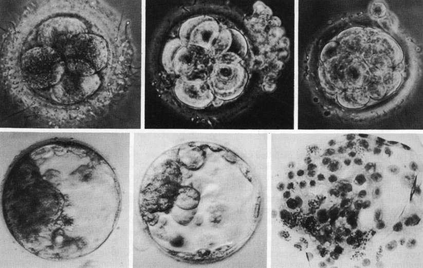 Stages of embryo