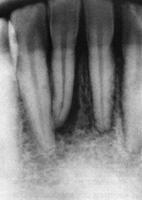 teeth will reform Differential Diagnosis!
