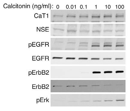 Freeman, M.R. DAMD17-02-1-0036 7 Figure 3. Calcitonin induces CaT1/TRPV6 expression and activates EGFR family receptor tyrosine kinases in LNCaP cells.