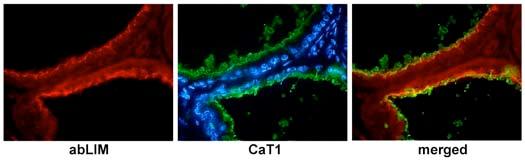 CaT1/TRPV6 in tumor cell growth and chemotaxis, yeast two hybrid analysis was performed to identify possible cooperating proteins.