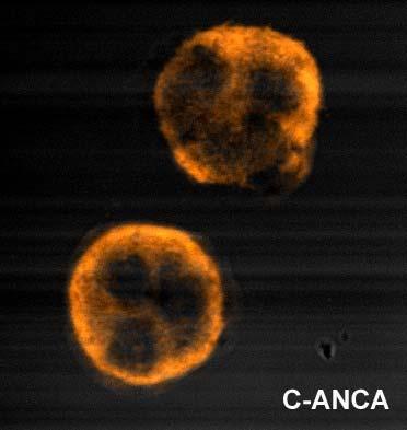Anti-Neutrophil Cytoplasmic Antibodies ANCAs are directed against