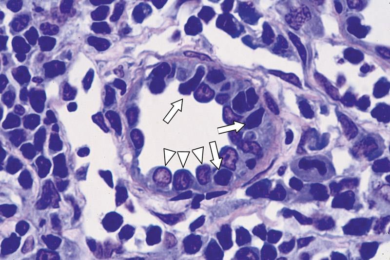 These venules have an unusual endothelial lining of tall cuboidal cells, and lymphocytes can travel between them. These venules also present in the appendix, tonsils, and Peyer s patches.