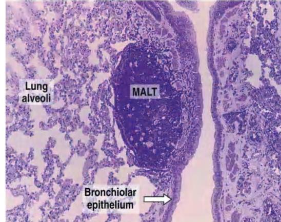 MUCOSA-ASSOCIATED LYMPHOID TISSUE & TONSILS The digestive, respiratory, and genitourinary tracts are common sites of microbial invasion because their lumens are open to the external environment.