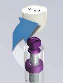 Pick up the implant body from the vial. Use caution when bringing implant to the surgical site.