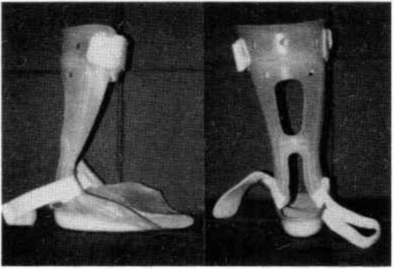 referred to as functional ankle foot orthosis Type 2 (FAFO (II)), which can deal with genu recurvatum and the severe spastic foot in walking.