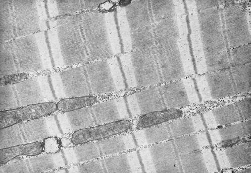 Chapter 6 Contraction of Skeletal Muscle Figure 6-2 Electron micrograph of muscle myofibrils showing the detailed organization of actin and myosin filaments.