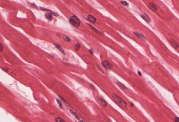 410 CHAPTER 10 MUSCLE TISSUE discs. An intercalated disc allows the cardiac muscle cells to contract in a wave-like pattern so that the heart can work as a pump. Figure 10.