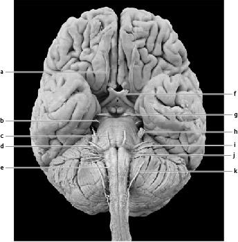 ANSWERS TO POST- LAB ASSIGNMENTS PART I. Check Your Understanding Activity 1: Learning the Cranial Nerves 1. Identify the cranial nerves on the accompanying photograph of a human brain. a. olfactory nerve b.