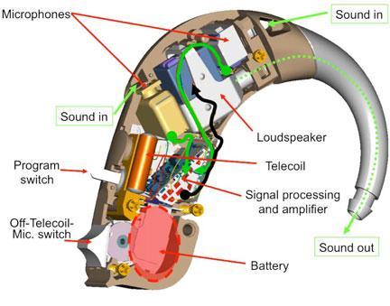 How Hearing Aids Work: Hardware Many