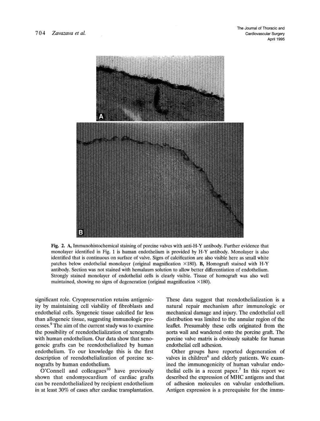 704 Zavazava et al. The Journal of Thoracic and April 1995 Fig. 2. A, Immunohistochemical staining of porcine valves with anti-h-y antibody. Further evidence that monolayer identified in Fig.