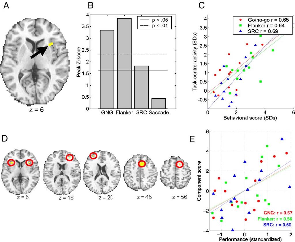 332 T.D. Wager et al. / NeuroImage 27 (2005) 323 340 Fig. 3. Right anterior insula and correlations with task performance.