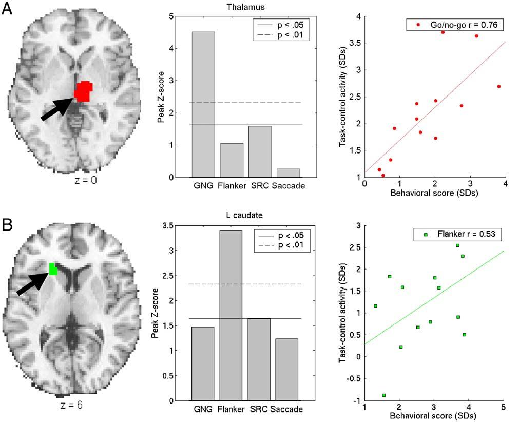 334 T.D. Wager et al. / NeuroImage 27 (2005) 323 340 Fig. 4. Selected unique regions showing correlations between activation and task performance.