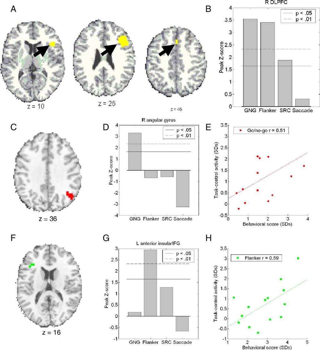336 T.D. Wager et al. / NeuroImage 27 (2005) 323 340 Fig. 5. Analyses of selected regions derived from meta-analysis.