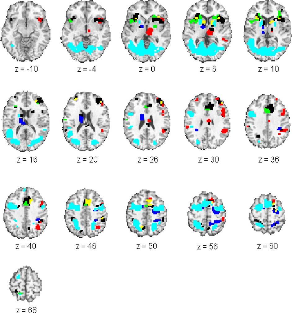 330 T.D. Wager et al. / NeuroImage 27 (2005) 323 340 Fig. 2. Common and unique regions in inhibition tasks. All regions shown are significant P < 0.