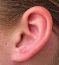 In the pedigree in Figure 8, three offspring have a trait attached earlobes that the parents do not have.