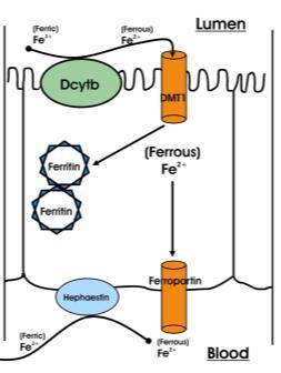 Chapter by M Torbenson Genetic/acquired Hepcidin Ferroportin Transferrin