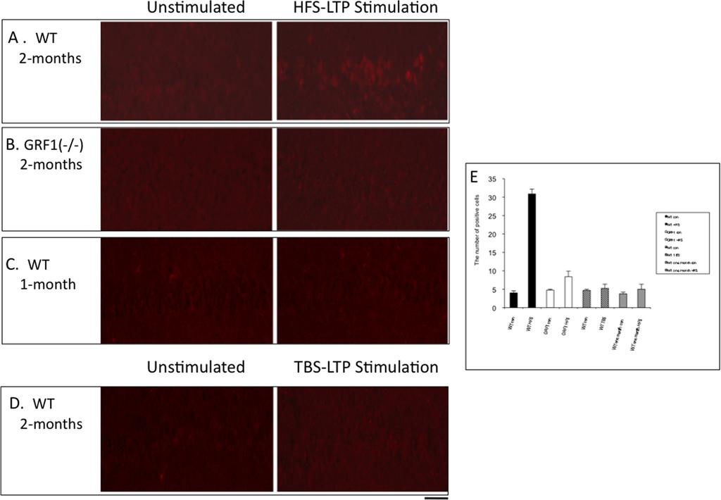 FIGURE 4. HFS-induced, but not TBS-induced, LTP in 2-month-old mice activates p38 MAP kinase activity in principal neurons of the CA1 hippocampus.