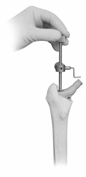 Use the Stem Alignment Guide) to check the orientation of the bow by rotating the arm to center over the neck and locking it in position (Figs. 15, 15a, & 15b).