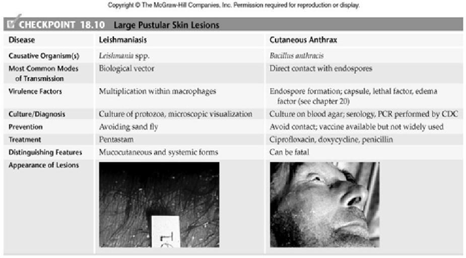Features of leishmaniasis and cutaneous anthrax pustular lesions 97 Scabies intense