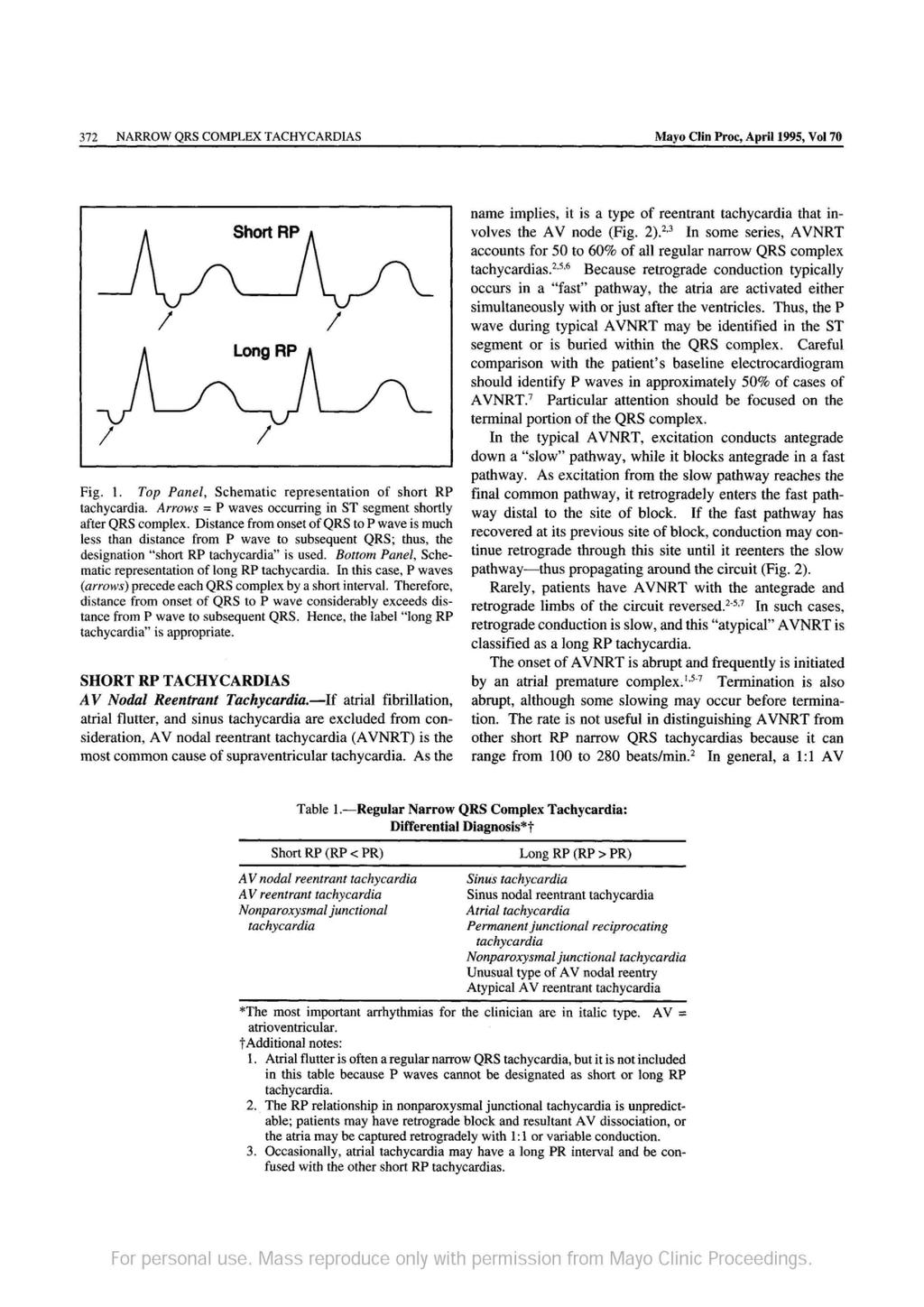372 NARROW QRS COMPLEX TACHYCARDIAS Mayo Clin Proc, April 1995, Vol 70 I Fig. 1. Top Panel, Schematic representation of short RP tachycardia.