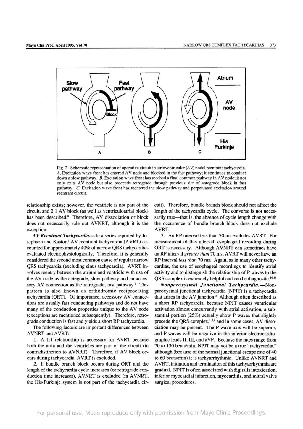 Mayo Clin Proc, April 1995, Vol 70 NARROW QRS COMPLEX TACHYC ARDIAS 373 Atrium AV node A B c His Purkinje Fig. 2.