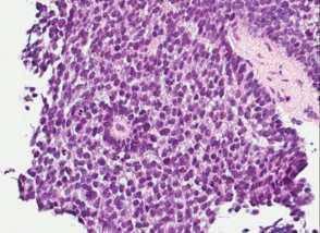 (Nuclear protein of the testis)-ihc and