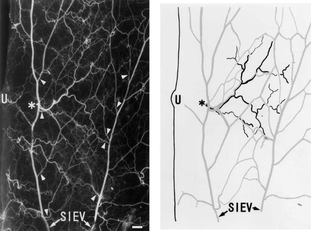 Anatomical relationship between arteries and veins in the paraumbilical region 553 Fig. 1 (Left) Arteriovenogram of the skin and subcutaneous tissue of the left abdomen.