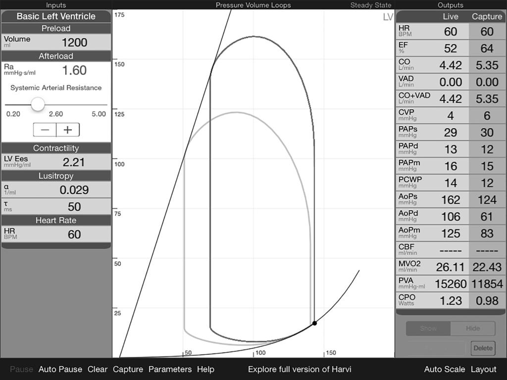 USE OF AN APP TO SIMULATE CARDIOVASCULAR PHYSIOLOGY 417 3b. PV loops: center panel.