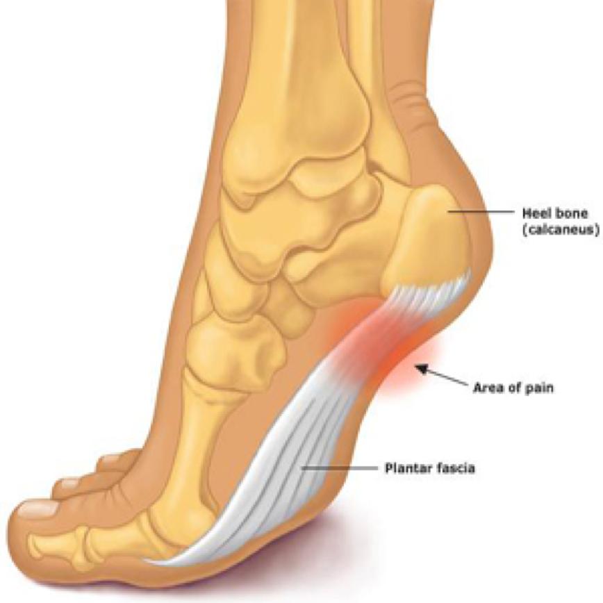 ANATOMICAL DESCRIPTION The foot, which serves double function bearing the weight of the body and performing dynamic movements necessary for walking, is comprised of 26 bones, 31 joints and 20