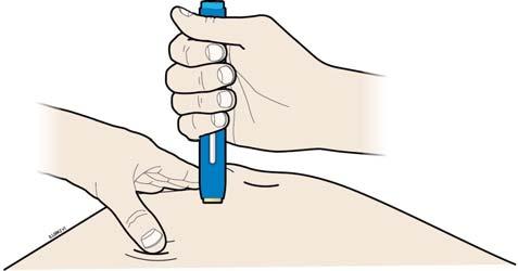 Pinch method Pinch the skin firmly between your thumb and fingers, creating an area about 2 inches wide.