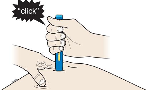 I When you are ready to inject, press the blue start button. J Keep pushing down on your skin. Your injection could take about 10 seconds.