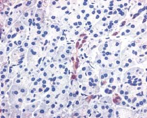 Immunostaining: original magnification 40. Corpus 4/10 cases, a nuclear staining pattern was found in some of the metaplastic cells and in cells of the adjacent gastric neck region (Figure 2e).