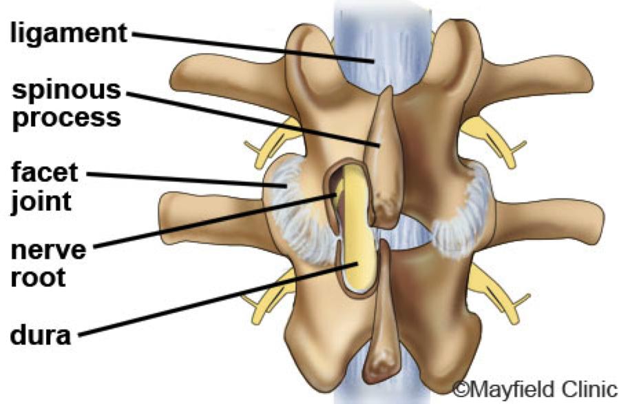 Many spine surgeons have specialized training in complex spine surgery. Ask your surgeon about their training, especially if your case is complex or you ve had more than one spinal surgery. Figure 2.