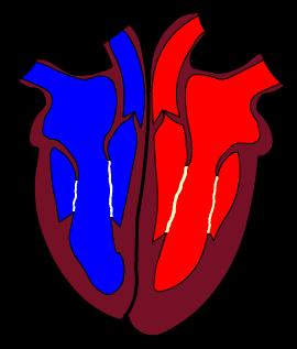 The circulatory system 4 of 36 Deoxygenated blood is pumped from the heart to the lungs through the pulmonary artery.