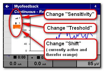 During the recording we can always adjust the sensitivity, threshold and shift, without interrupting the treatment.