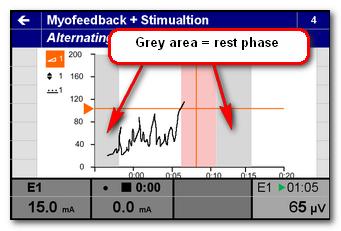 This area was defined in the Stimulation above Threshold - Settings as Rest Time. White area = active EMG In the white area the patient should activate the muscle of interest.