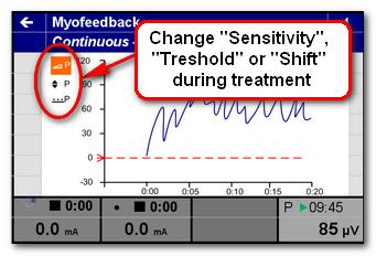 Just like during the EMG treatment you can change the Sensitivity, Threshold or Shift.