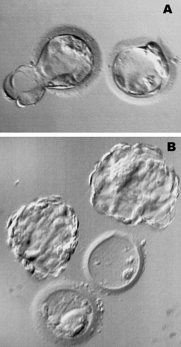 26 embryos after splitting at the 2- to 5-cell stage; P<.001, Pearson s c 2 -test).