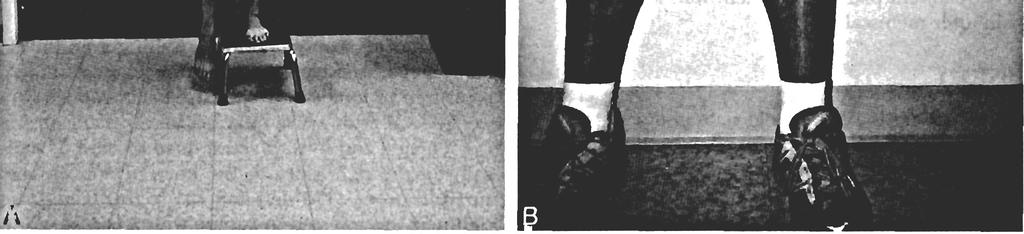 - Differential Diagnosis Based on Results of Physical Examination The flexibility of the rectus femoris, hamstring, iliotibial band, and gastrocnemius was not dramatically different from one side to