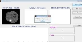 3 Experimental Results for tumor detection The methodology of Region Growing was applied of MR