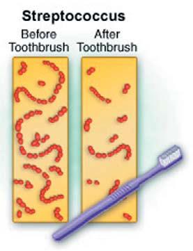 There are studies on the comparison of toothbrushes and miswak for plaque removal, but so far no data are available on salivary bacterial count reductions by using the dip-slide method along with the