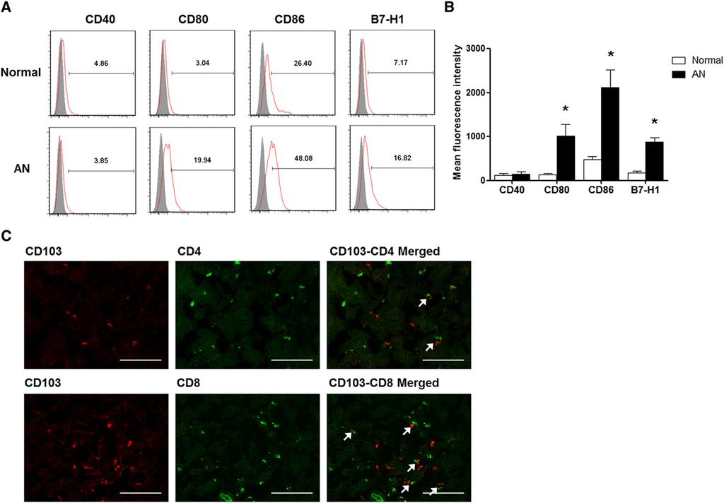 Figure 6. Activated CD103 + DCs colocalize with CD8 T cells in kidneys of AN mice.