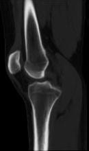 Evaluating post-surgical knee pain Guiding subsequent management Conclusion Addition of to