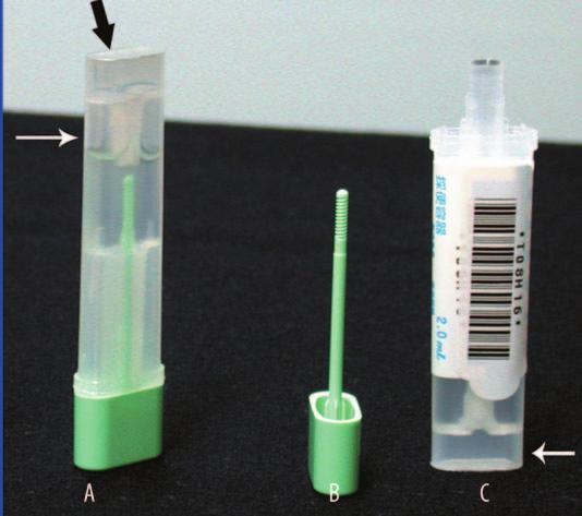 Med Sci Monit, 2006; 12(6): MT27-32 Rozen P et al Automated occult blood evaluation MT Figure 1. Left Stool probe and fecal sample storage tube. The closed tube is 8 cm long and 2 cm wide (A).