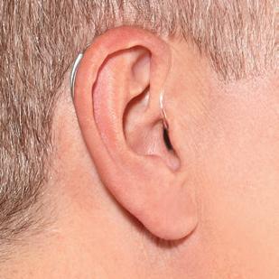hearing loss, cosmetic